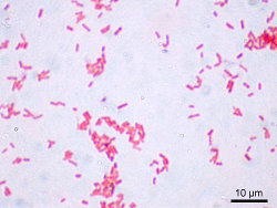 Bact�rie Gram- : Escherichia Coli