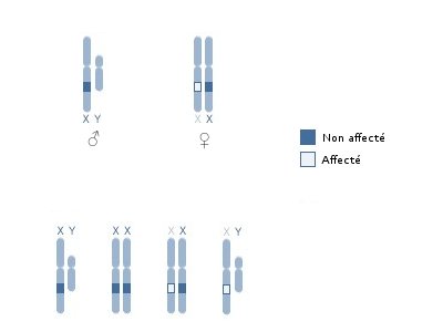 La génétique de l'hémophilie La génétique de l'hémophilie