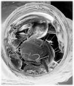 Acarapis woodi dans une trach�e d'abeille
