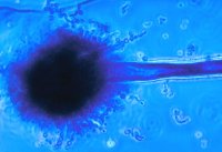 Aspergillus flavus - les filaments conidiophores avec la tête aspergillaire Aspergillus flavus - les filaments conidiophores avec une tête aspergillaire sur laquelle naissent les spores