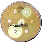 Une boîte de Petri où l'on voit l'action antibactérienne d'une substance antibiotique